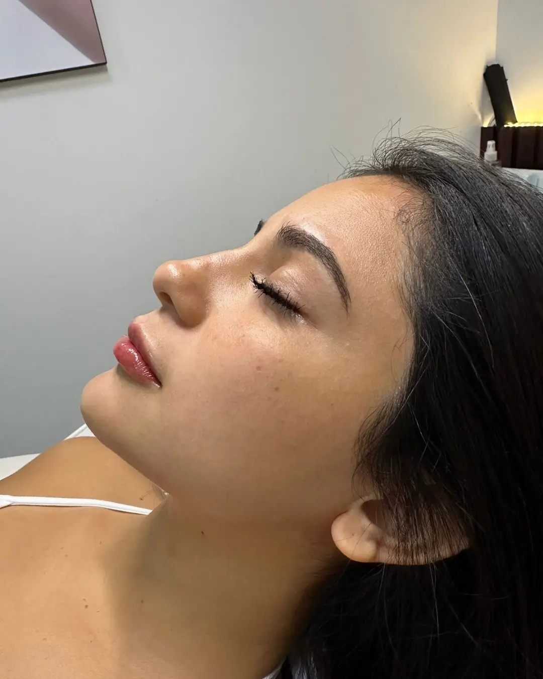 Después del facial premium con hidrodermoabrasión — Pura Estética Cancún