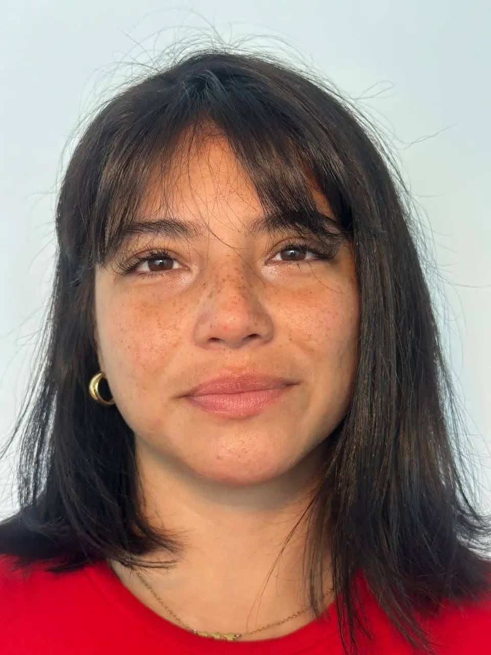 Antes — Aumento de labios resultado 2 — Pura Estética Cancún